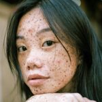 Woman with Freckles and a Blemish