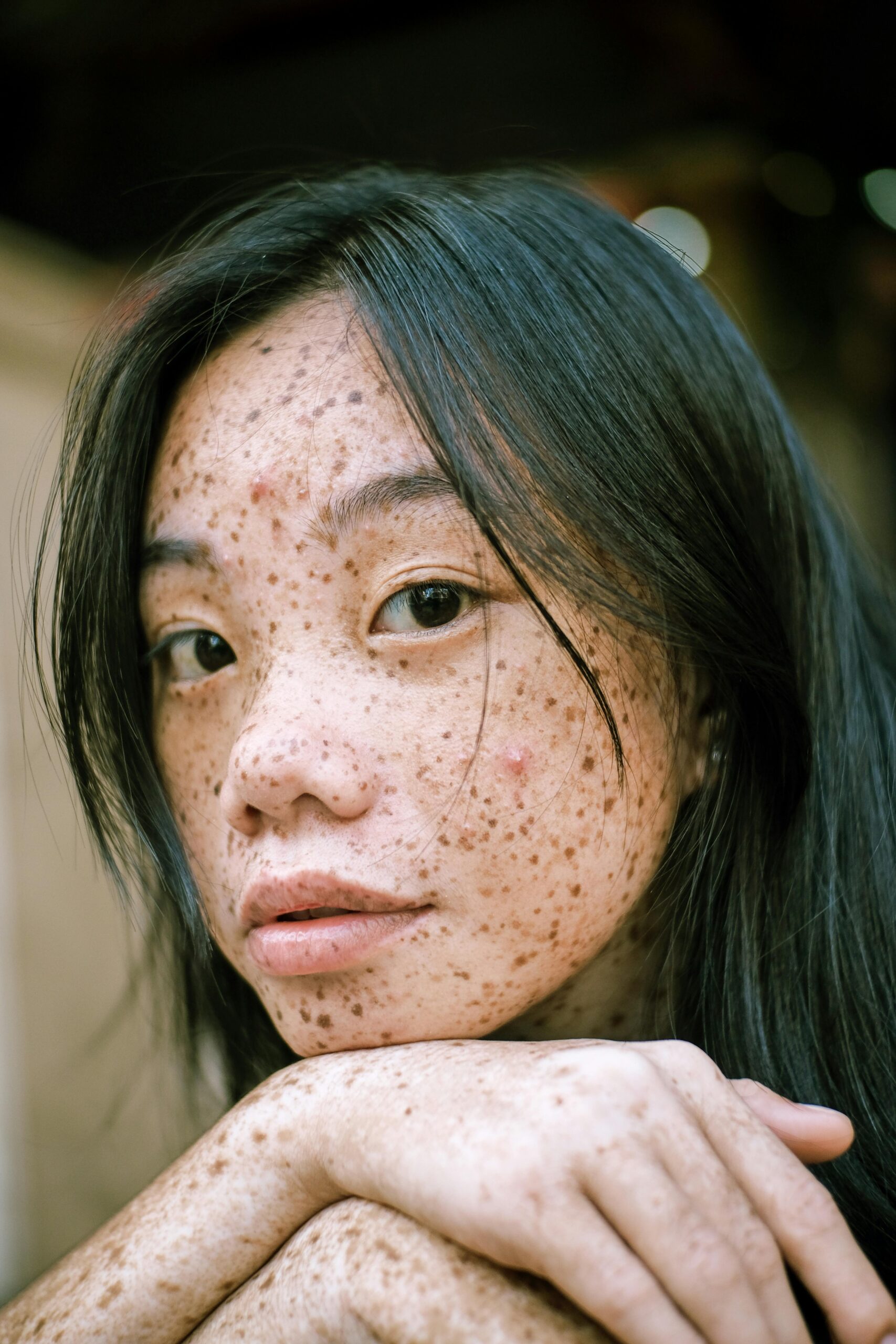 woman with freckles and a blemish