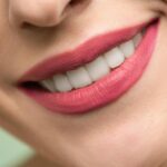 Woman Smiling with White Teeth