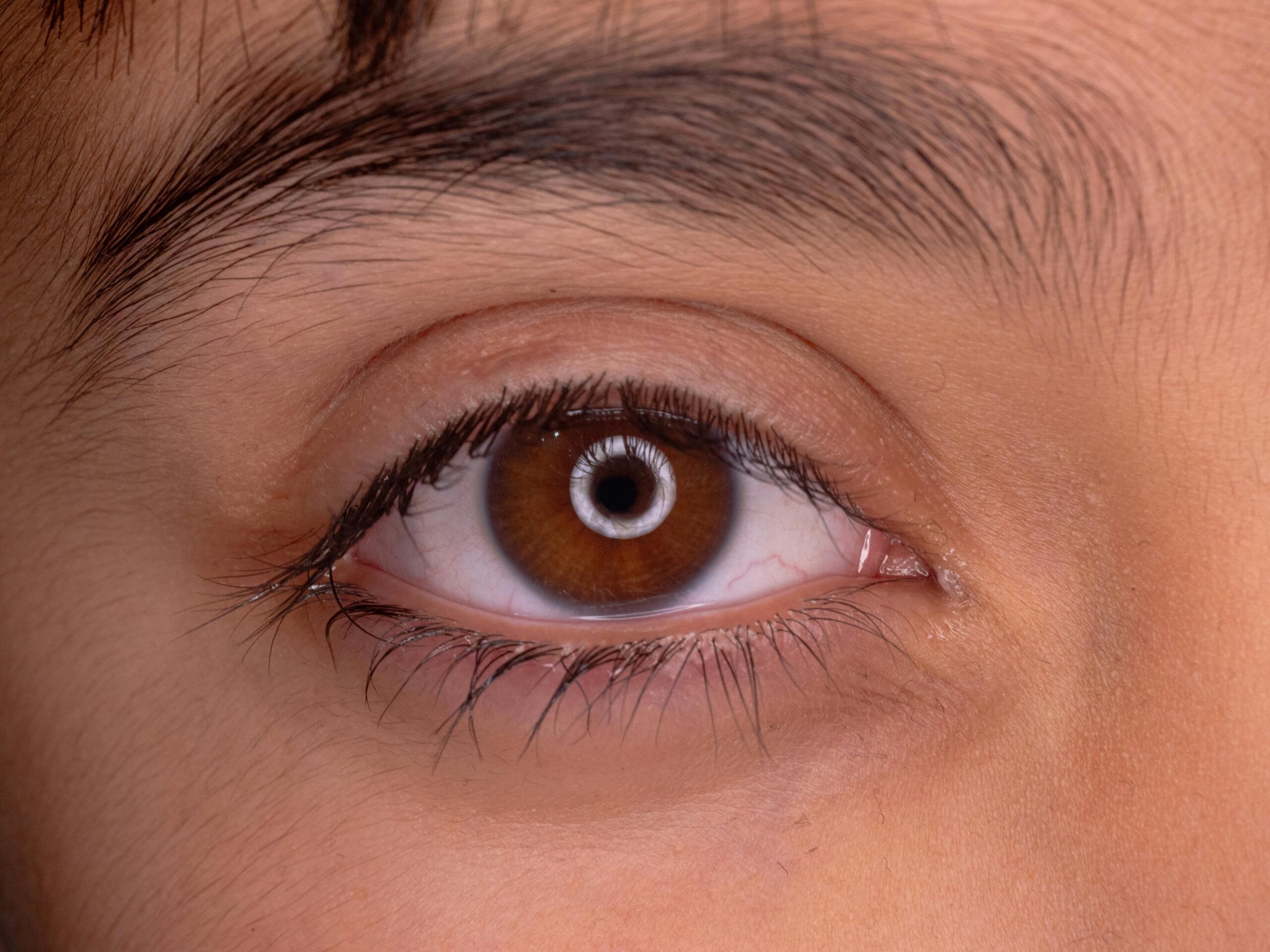 Person with brown eyes